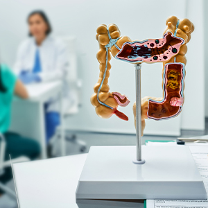 Doctor and patient with colon model